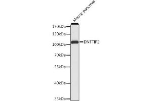 Western blot analysis of extracts of mouse pancreas, using DNTTIP2 antibody (ABIN7266732) at 1:1000 dilution. (DNTTIP2 抗体  (AA 1-300))