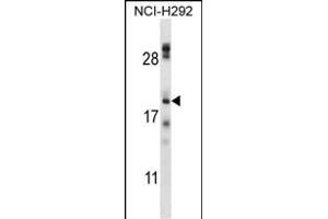 TMEM17 Antibody (N-term) (ABIN657609 and ABIN2846606) western blot analysis in NCI- cell line lysates (35 μg/lane). (TMEM17 抗体  (N-Term))