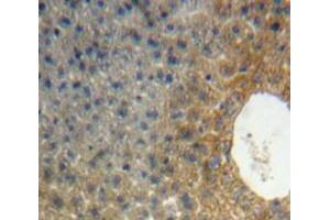 IHC-P analysis of Liver tissue, with DAB staining. (APOH 抗体  (AA 20-297))