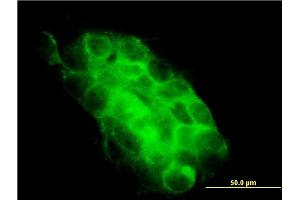 Immunofluorescence of monoclonal antibody to USP31 on A-431 cell. (USP31 抗体  (AA 1254-1352))