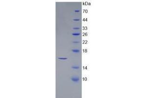 SDS-PAGE analysis of Human SFRP5 Protein. (SFRP5 蛋白)