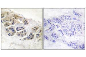 Immunohistochemistry (IHC) image for anti-Mammaglobin (Internal Region) antibody (ABIN1848654) (Mammaglobin 抗体  (Internal Region))