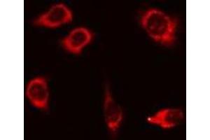 ABIN6275885 staining 293 cells by IF/ICC. (Desmoglein 1 抗体  (N-Term))