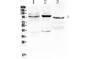 Western blot analysis of ATF6 using anti- ATF6 antibody . (ATF6 抗体  (C-Term))