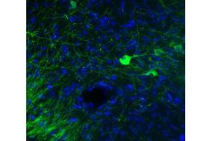 Indirect immunohystochemistry of a PFA fixed mouse brain section (dilution 1 : 500; green). (Tyrosine Hydroxylase 抗体)