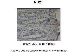Sample Type :  Pig stomach  Primary Antibody Dilution :  1:500  Secondary Antibody :  Anti-rabbit-HRP  Secondary Antibody Dilution :  1:1000  Color/Signal Descriptions :  Brown: MUC1 Blue: Nucleus  Gene Name :  MUC1  Submitted by :  Dr. (MUC1 抗体  (C-Term))