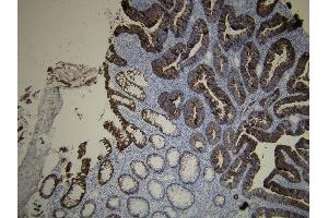 Immunohistochemistry (IHC) image for anti-Keratin 20 (KRT20) (AA 408-424), (C-Term) antibody (ABIN870620) (KRT20 抗体  (C-Term))