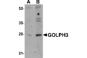 Western blot analysis of GOLPH3 in rat lung tissue lysate with GOLPH3 antibody at (A) 0.