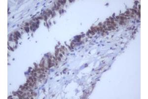 Image no. 7 for anti-DEAD (Asp-Glu-Ala-Asp) Box Polypeptide 59 (DDX59) (AA 1-303) antibody (ABIN1490728)