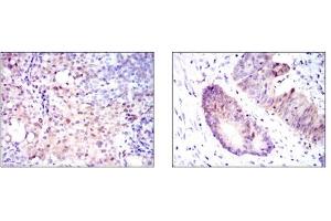 Immunohistochemistry (IHC) image for anti-Argininosuccinate Synthase 1 (ASS1) antibody (ABIN1105455) (ASS1 抗体)