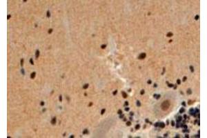 ARRB2 polyclonal antibody  (4 ug/mL) staining of paraffin embedded human cerebellum. (Arrestin 3 抗体  (Internal Region))