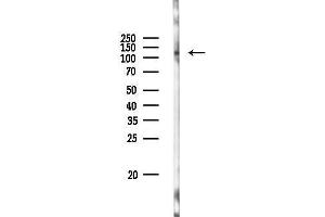 Western blot analysis of lysates from PC12 cells(LPS 4h treatment), using srGAP2 Antibody at 1/1000 dilution.