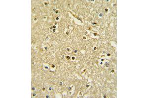 Immunohistochemistry (IHC) image for anti-Paired Box 6 (PAX6) (AA 183-210) antibody (ABIN5537274)