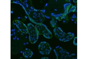 IF analysis of HSD11B2 using anti-HSD11B2 antibody (ABIN3043846).