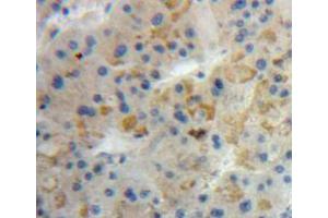 Used in DAB staining on fromalin fixed paraffin-embedded liver tissue (ANG 抗体  (AA 25-147))