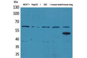 Western Blotting (WB) image for anti-Zinc Finger Protein 307 (ZKSCAN4) (Internal Region) antibody (ABIN3178345) (ZKSCAN4 抗体  (Internal Region))