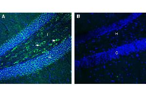 Expression of FLRT3 in mouse hippocampus.