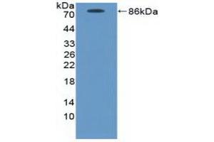 Detection of Recombinant ICAM1, Canine using Polyclonal Antibody to Intercellular Adhesion Molecule 1 (ICAM1) (ICAM1 抗体  (AA 25-531))