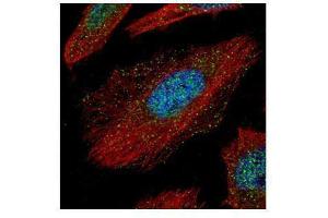 ICC/IF Image Confocal immunofluorescence analysis (Olympus FV10i) of paraformaldehyde-fixed HeLa, using TAB1, antibody (Green) at 1:500 dilution. (TAB1 抗体)