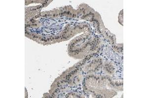 Immunohistochemical staining of human gallbladder with GPR158 polyclonal antibody  shows weak nuclear positivity in glandular cells.