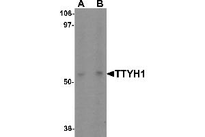 Western blot analysis of TTYH1 in Raji cell lysate with TTYH1 antibody at (A) 1 and (B) 2 µg/mL. (TTYH1 抗体  (C-Term))