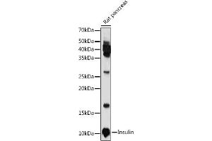 Western blot analysis of extracts of Rat pancreas, using Insulin antibody (ABIN3022884, ABIN3022885, ABIN3022886 and ABIN6219279) at 1:1000 dilution. (Insulin 抗体  (AA 1-110))