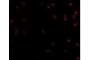 Immunofluorescence of Integrin alpha 4 in Jurkat cells with AP30436PU-N Integrin alpha 4 antibody at 2 μg/ml. (ITGA4 抗体  (Center))