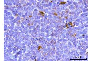 IHC analysis of TFEB using anti-TFEB antibody (ABIN7600648). (TFEB 抗体  (AA 214-326))