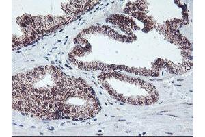 Image no. 1 for anti-Protein Phosphatase 1, Regulatory (Inhibitor) Subunit 15A (PPP1R15A) antibody (ABIN1498364) (GADD34 抗体)
