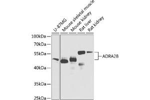 Western blot analysis of extracts of various cell lines, using B Antibody (ABIN6134019, ABIN6136597, ABIN6136598 and ABIN6224629) at 1:1000 dilution. (ADRA2B 抗体  (AA 1-100))