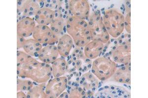 Used in DAB staining on fromalin fixed paraffin-embedded testis tissue (HSPA2 抗体  (AA 1-633))