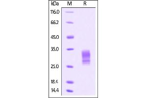 SDS-PAGE (SDS) image for Gremlin 1 (GREM1) (AA 25-184) (Active) protein (His tag) (ABIN4949103)