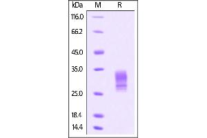 Human Gremlin / GREM1, His Tag on SDS-PAGE under reducing (R) condition. (GREM1 Protein (AA 25-184) (His tag))