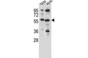Western Blotting (WB) image for anti-Cysteine Sulfinic Acid Decarboxylase (CSAD) antibody (ABIN2996373) (CSAD 抗体)