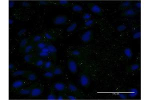 Immunofluorescence of monoclonal antibody to APOC3 on HeLa cell. (APOC3 抗体  (AA 21-99))