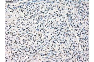 Immunohistochemical staining of paraffin-embedded pancreas tissue using anti-LTA4Hmouse monoclonal antibody. (LTA4H 抗体)