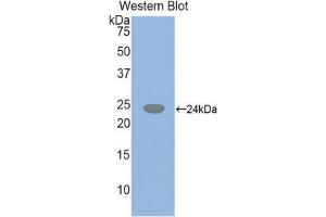 Western Blotting (WB) image for anti-Glutathione Synthetase (GSS) (AA 270-474) antibody (ABIN1859086) (Glutathione Synthetase 抗体  (AA 270-474))