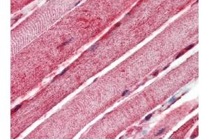 Human Skeletal Muscle (formalin-fixed, paraffin-embedded) stained with BAK1at 10 µg/ml followed by biotinylated goat anti-rabbit IgG secondary antibody, alkaline phosphatase-streptavidin and chromogen. (BAK1 抗体  (N-Term))