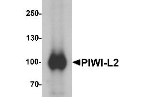 Western blot analysis of PIWI-L2 in HepG2 cell lysate with PIWI-L1 antibody at 1 µg/mL. (PIWIL2 抗体  (Middle Region))