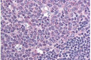 Human Tonsil (formalin-fixed, paraffin-embedded) stained with CXCR7 antibody ABIN295878 at 10 ug/ml followed by biotinylated goat anti-rabbit IgG secondary antibody ABIN481713, alkaline phosphatase-streptavidin and chromogen. (CXCR7 抗体  (AA 100-150))