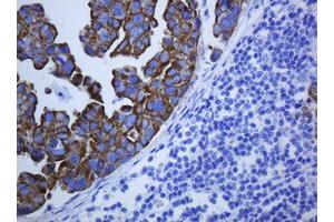 Image no. 6 for anti-Keratin 5 (KRT5) (AA 1-273) antibody (ABIN1490696) (Cytokeratin 5 抗体  (AA 1-273))