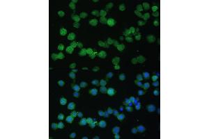 Immunofluorescence analysis of THP-1 cells using CD35/CD35/CR1 antibody (ABIN6130075, ABIN6138990, ABIN6138991 and ABIN6214176) at dilution of 1:100. (CD35 抗体  (AA 420-550))