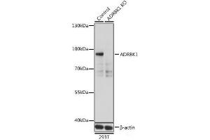 Western blot analysis of extracts from normal (control) and ADRBK1 knockout (KO) 293T cells using ADRBK1 Polyclonal Antibody at dilution of 1:500. (GRK2 抗体)