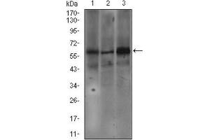 Western Blotting (WB) image for anti-Fc Fragment of IgE Receptor Ia (FCER1A) (AA 42-103) antibody (ABIN1845339) (Fc epsilon RI/FCER1A 抗体  (AA 42-103))