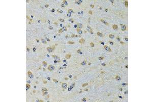 Immunohistochemistry of paraffin-embedded rat brain using DARS antibody. (DARS 抗体  (AA 222-501))