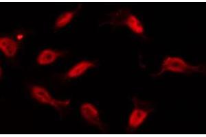 Immunofluorescence (fixed cells) (IF/ICC) image for anti-TAF6-Like RNA Polymerase II, P300/CBP-Associated Factor (PCAF)-Associated Factor, 65kDa (TAF6L) (N-Term) antibody (ABIN6265440)