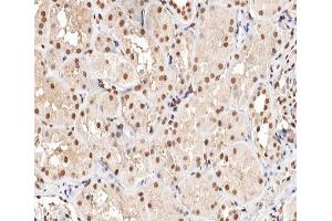 ABIN6266470 at 1/200 staining human kidney tissue sections by IHC-P. (MAPKAP Kinase 5 抗体  (pThr182))