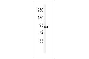 Western blot analysis of ANR49 Antibody (Center) (ABIN651157 and ABIN2840103) in Jurkat cell line lysates (35 μg/lane). (ANKRD49 抗体  (AA 80-109))