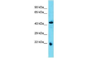 Host: Rabbit  Target Name: Abhd4  Sample Tissue: Rat Pancreas lysates  Antibody Dilution: 1. (ABHD4 抗体  (N-Term))