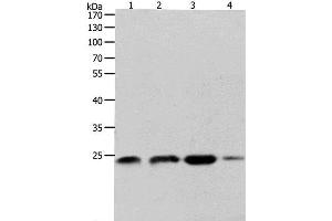 Western Blot analysis of K562, 231 and Hela cell, Human fetal brain tissue using RHOA Polyclonal Antibody at dilution of 1:400 (RHOA 抗体)